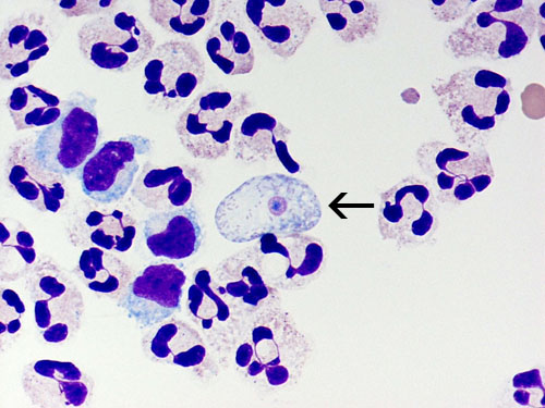 Naegleria fowleri, photo credit: CDC